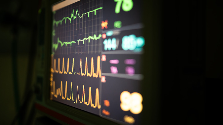 Patient vital signs