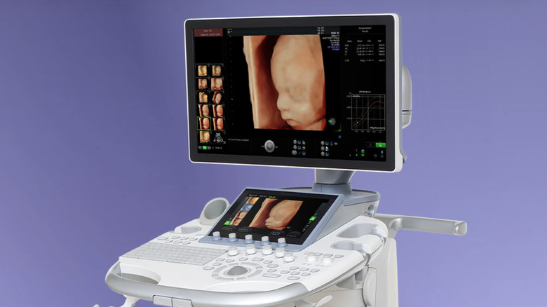 Volusan S10 pre-natal ultrasound