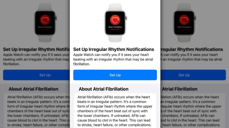 Apple wath set up irregular rhythm notifications