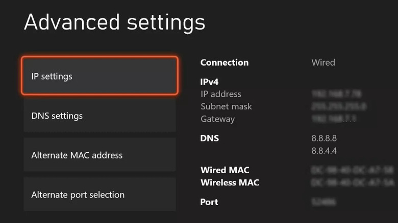 Xbox Series X|S network settings