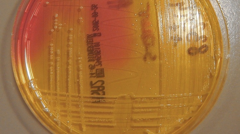 Staphylococcus aureus in petri dish