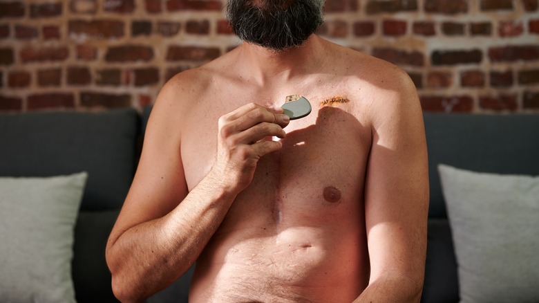 man holds pacemaker over chest  