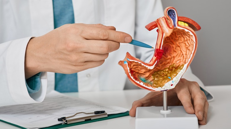 doctor pointing at stomach model