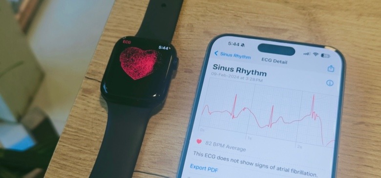 Apple Watch ECG system