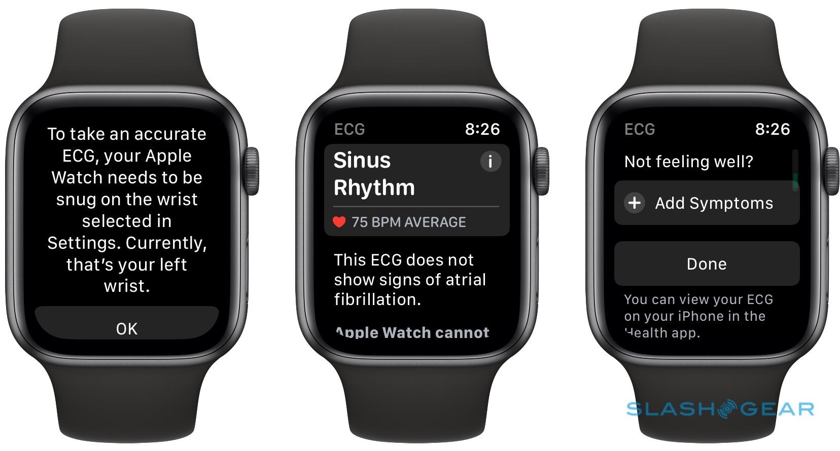 The Apple Watch Ecg App Is My Heart S New Best Friend Slashgear