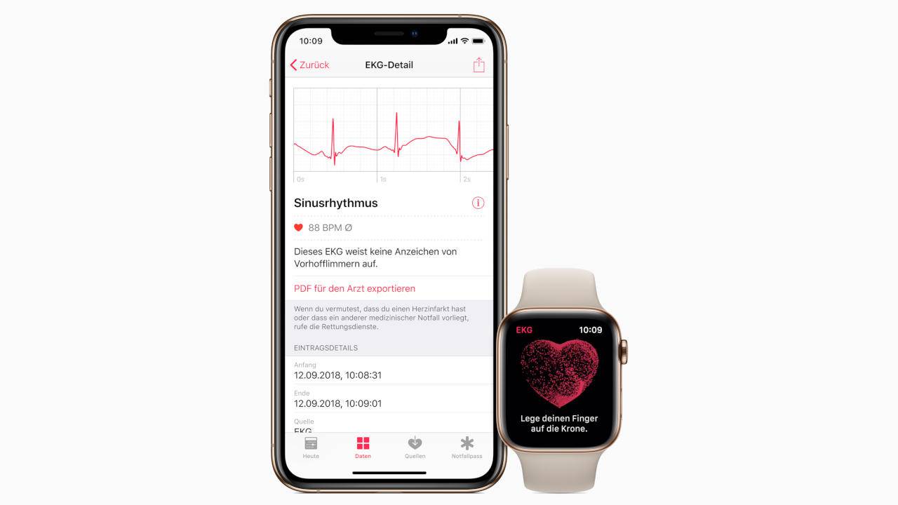 smartwatch ekg sensor